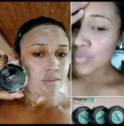 Savon anti-boutons, vergetures