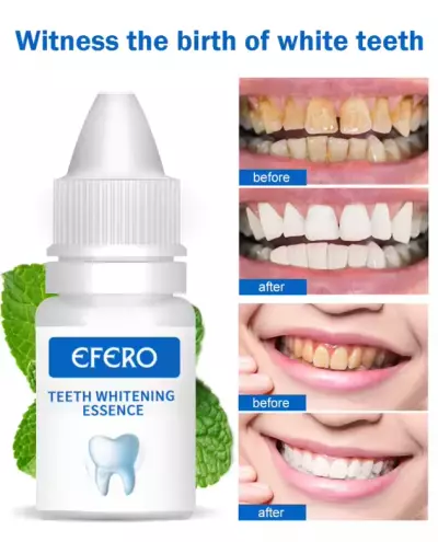 EFORO Sérum (blanchisseur de dents)