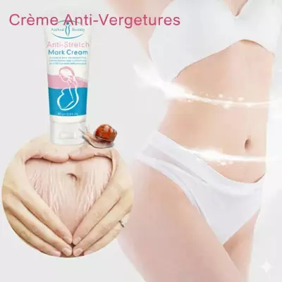 CRÈME ANTI VERGETURES 